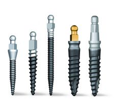 Mini Implantate Zahnimplantate Linz Traun Dr. med. dent. Dana Alexandru